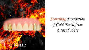 How to start a grillz business? Sell Grillz Top Cash Paid For Gold Diamond Teeth Trade Up Luxe Grillz