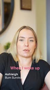 ⚠ Content Warning: This video contains real and potentially distressing  images of burn injuries., ., Today is the final chance to support our  #RebuildingLives Summer Appeal — and have your donation ...