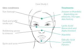 Image Result For Chemical Peel Strength Chart Microblading