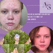 Angel Skin Care and Glow