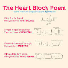 Image result for Atrioventricular Block