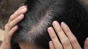 La tinta dei capelli è una scelta molto personale e i riflessi del nero sono tantissimi. Non Avrai Bisogno Della Tinta Ogni 2 Settimane Trucco Fenomenale Per Eliminare I Capelli Bianchi