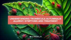 Image result for Trombicula autumnalis bites