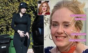 61,680,167 likes · 23,491 talking about this. Adele Weight Loss Why Shedding The Pounds Made The Singer Look So Different Daily Mail Online
