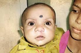 Cleft-Kinder-Hilfe • Professor Hermann Sailer Stiftung