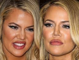 Khloe kardashian has reportedly spent over $3 million in her body transformation. Pin On Face Surgeries