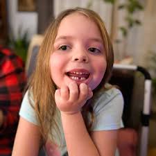 🦷#DianaBanana lost her first tooth today!