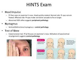 Image result for HiNTs Exam