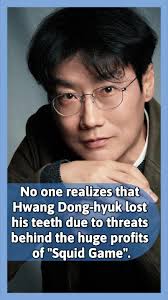 How Did The Guy Lose The Tooth Squid Games