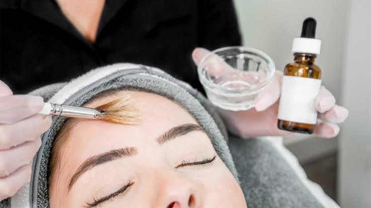 Chemical peel session at Profrea clinic