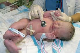 Image result for Labor Sedation