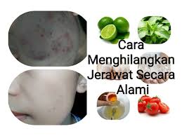 Cara menghilangkan jerawat dengan cepat memakai campuran kunyit dan pisang: Cara Menghilangkan Jerawat Dengan Cepat Secara Alami Novie Marru Youtube