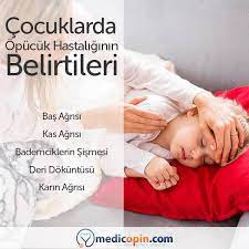 mayo klinik e gore nezle ile ayni etkilerle baslayan opucuk hastaligi cocuklarda bir aydan uzun sure etkili olabilir cocuk hastaliklari konusunda dunyanin ond
