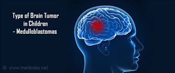 Still, cancer is the second leading cause of death in children younger than 15 years old, after accidents. Brain Tumor In Children Types Causes Symptoms Diagnosis Treatment