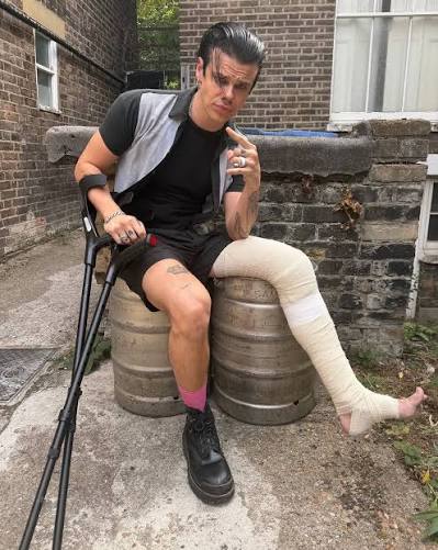 Yungblud recently injured his leg while dirt biking, but he says he has no intention of canceling his upcoming tour dates: "Leg f*cked. Still giggin. Still standin (sort of)."
