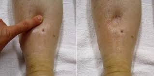 Ketika anda duduk, posisikan kaki berada di atas pinggang. Kaki Bengkak Saat Hamil Penyebab Dan Cara Mengatasi Theasianparent Indonesia