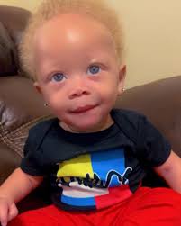 Baby Chosyn Amir he is 10 month old🥰❤️