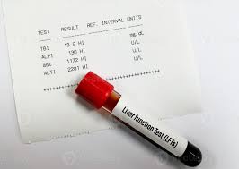 Image result for Liver Function Test Abnormality