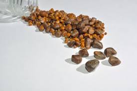 Then i will get another sonogram to maybe i'm just the 1 out of 100 that had problems. Gallstones Gallbladder Attack