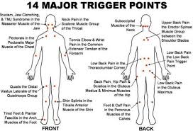 Bellabaci Cupping Therapy The Creator Of The Cupping Massage System Trigger Points Trigger Point Therapy Medical Massage