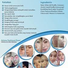 Krim jerawat himalaya mampu mengobati jerawat sembari membantu menyembuhkan kulit anda, membuatnya lembut dan halus dengan penggunaan reguler. Krim Parut Jerawat Startseite Facebook