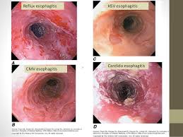 It connects the pharynx to the stomach; Laboratory 20 Diagnosis 20of 20gi 20and 20intra Abdominal 20infection