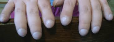 Image result for Digital Clubbing