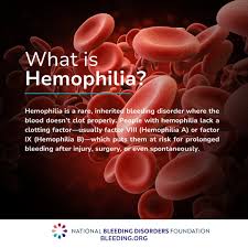 Image result for Factor IX Deficiency