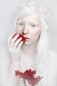 Nastya Zhidkova With Pin Curls In Hair Holding Red Berries Albinism Portrait Photography Albino