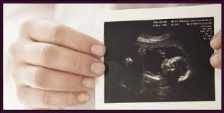 Pregnancy counseling & information services, pregnancy clinics. Abortion Info Keller Tx Clinic Options Sti Testing Pregnancy Help 4u