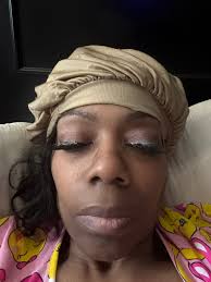 Prayers for possible shingles diagnosis