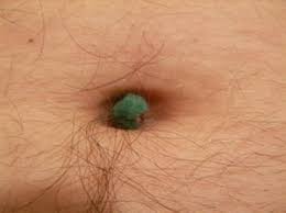 Navel Lint Simple English Wikipedia The Free Encyclopedia Here are all the possible meanings and translations of the word navel. navel lint simple english wikipedia