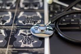 Image result for Sinus CT