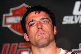 Chael Sonnen hypnotized during secret therapy sessions with sports  psychologist