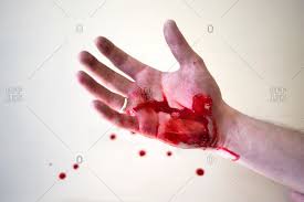Скачивай и слушай hurts blood tears gold и hurts silver lining на zvuk.top! Blood Injury Stock Photos Offset