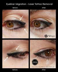 After the tattooing, rita put some eyedrops in to flush out any bits of dye that got into my eyes, took some after shots (with very watery eyes) and then i was done (the labels are switched around in the photo here). Eyeliner Tattoo Places Near Me Tattoo Design