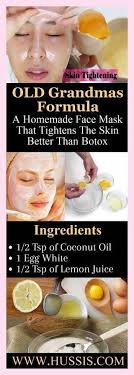 Laurie Ostrom (vinnie62)