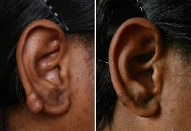 The campaign for african american rights—usually referred to as the civil rights movement or the freedom movement—went forward in the 1940s and '50s in persistent and deliberate steps. African American And Ethnic Skin Dermatology Black Dermatologist