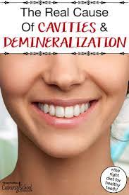 The Real Cause Of Cavities Demineralization The Right Diet For Healthy Teeth Tooth Decay Healthy Teeth Receding Gums