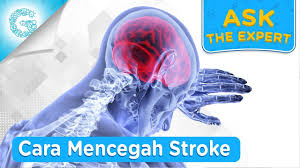 Gejala stroke ringan tanda tanda munculnya stroke ringan terkadang tidak disadari karena cenderung cepat hilang dengan sendirinya. Cara Mudah Mencegah Stroke Dr L Aswin Sp Pd Youtube