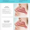 I first learned about this probiotic nasal spray from dr klinghardt. 1