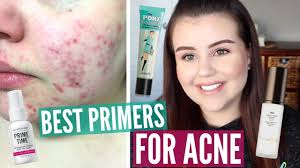 best face primers for acne my top 5