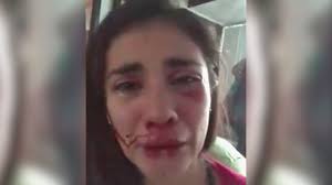 Ensangrentada y rogando ayuda: revelan videos de Eileen Moreno tras la  golpiza de la que acusa a su ex