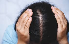 Once you get a specific diagnosis, then you can know the causes associated with that diagnosis. the cause of your particular form of hair loss will point you toward the right treatment. Hair Loss Treatment In Surat Gujrat Hair N Images Clinic