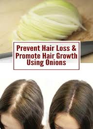 Prevent Hair Loss Promote Hair Growth Using Onions Help Hair Loss Promotes Hair Growth Grow Hair