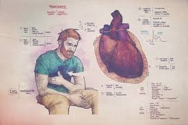 Pericarditis is a heart disease and means that the thin tissue sac around the heart is inflamed. Acute Pericarditis Patient Presentation Sketchbook Md