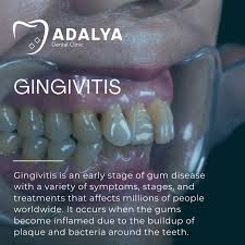 Image result for Gingivitis