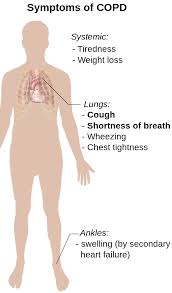 Difference Between Copd Symptoms Copd Diabetes Education