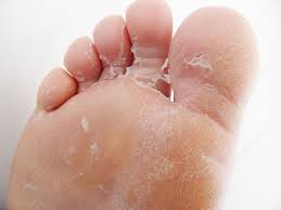 No pedicure can achieve these results! A Photo Diary Of Footner Socks The Genius Gross So Gross Way To Get Rid Of Dry Skin On Your Feet