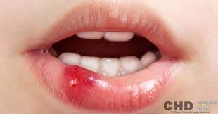 Pin On Lip Care